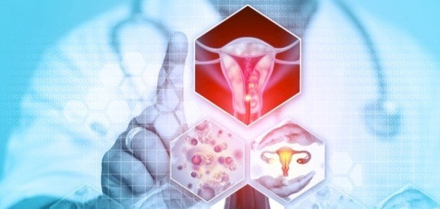 Female Sexually Transmitted Diseases